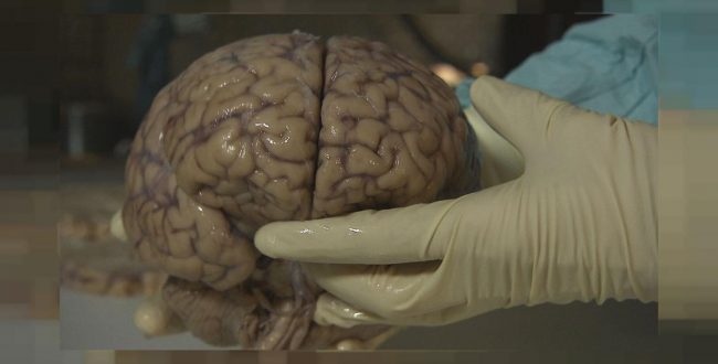 تحقیق جدید در مورد مغز چه می‌گوید؟ مغز زنان داغ‌تر است یا مردان؟